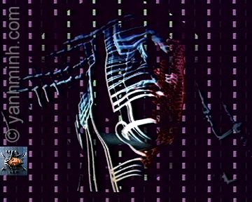 Media000
